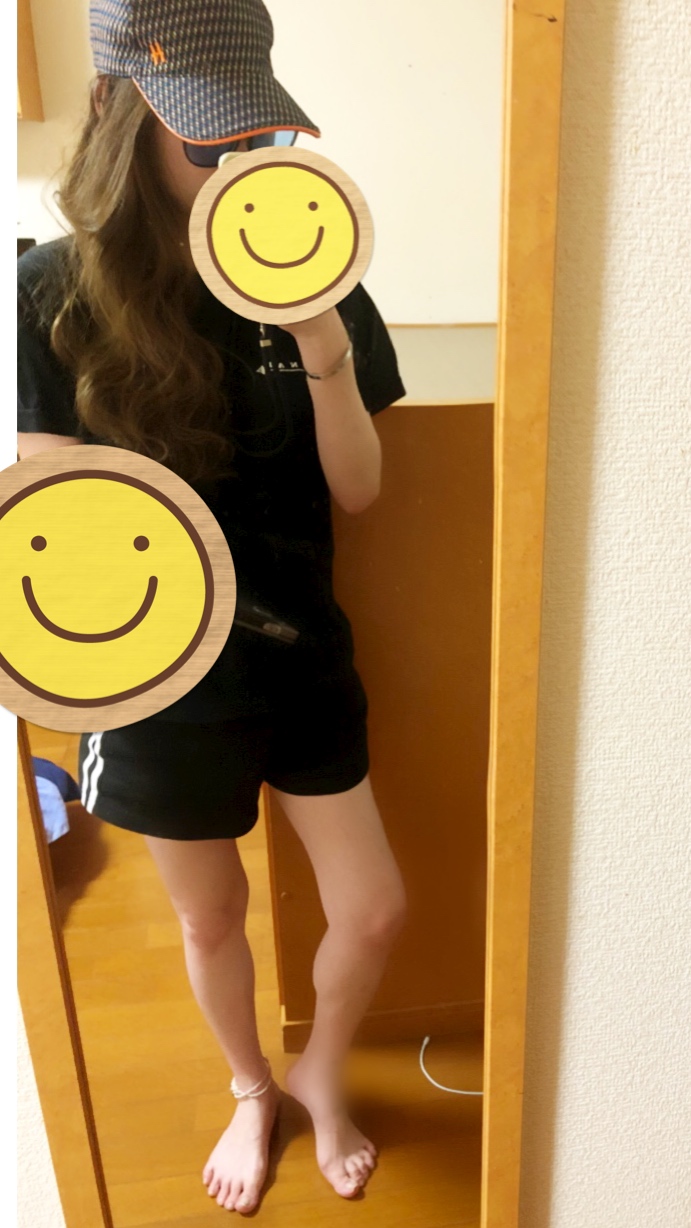 える